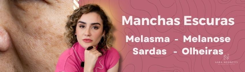 Manchas Escuras