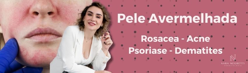 Pele Avermelhada